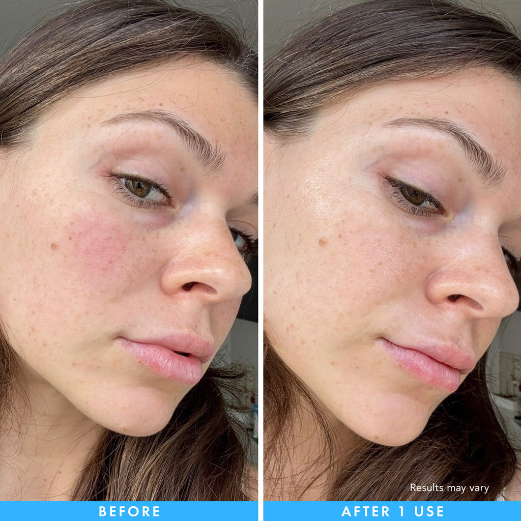 Cryo and Soothing Hydrogel Mask L7
