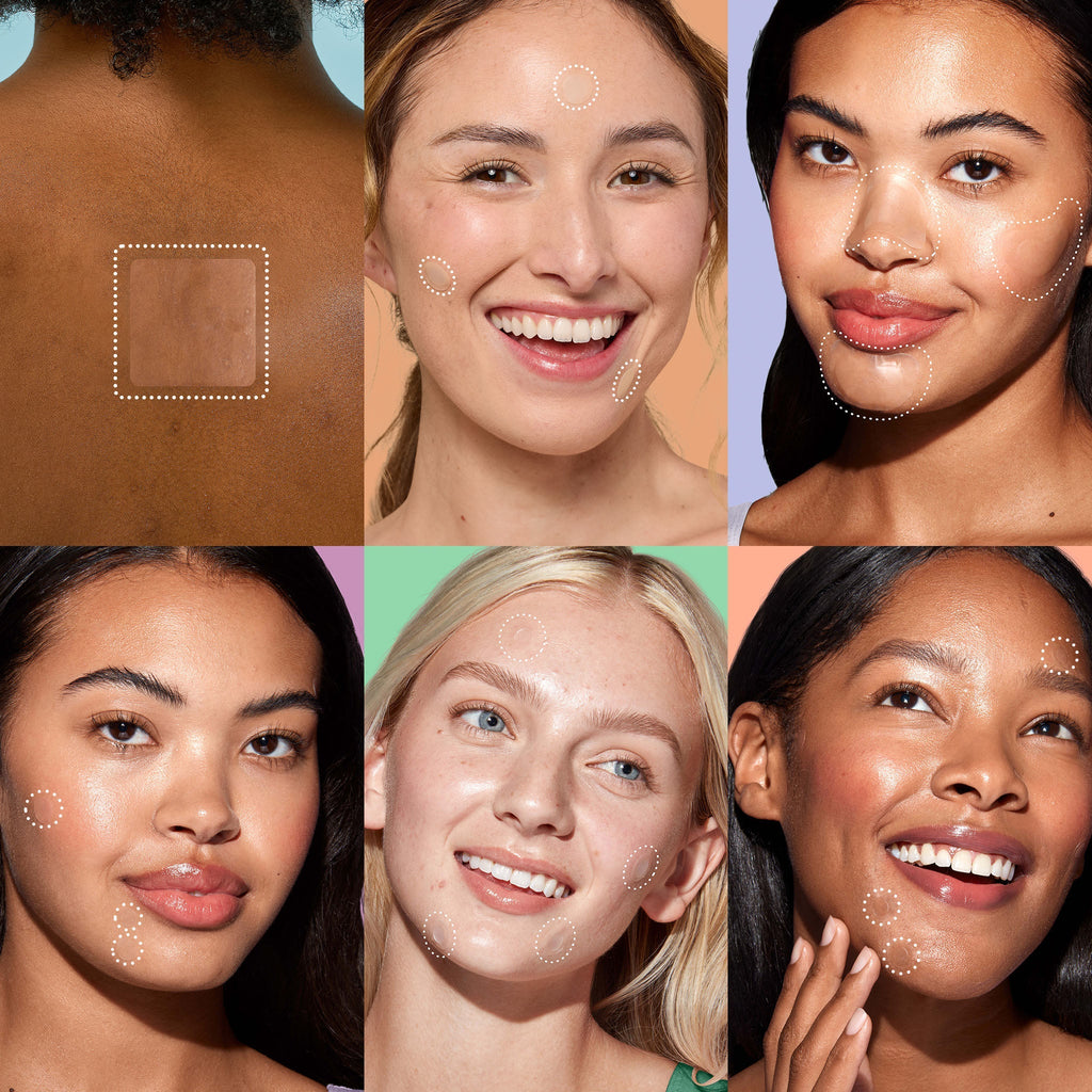 Miracle Patch Ultimate Blemish Patch Kit L5